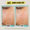 Hidratante habilmente transparente para peles com tendência a acne com ácido salicílico