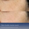 Advanced Night Repair Serum Duo Sincronizado Complexo Multi-Recuperação Comentários